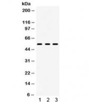 Western blot testing of 1) rat brain, 2) rat testis and 3) human U-87 MG lysate with 5HT2AR antibody. Predicted/observed molecular weight ~53 kDa.