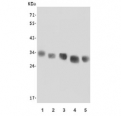 Western blot testing of 1) rat heart, 2) rat kidney, 3) mouse heart, 4) mouse kidney and 5) mouse NIH 3T3 lysate with LOX antibody. Expected molecular weight: ~47 kDa (unprocessed/unmodified), ~50 kDa (glycosylated), ~32 kDa (processed form).
