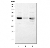 Western blot testing of 1) rat liver, 2) rat lung and 3) mouse liver tissue lysate with LOX antibody. Expected molecular weight: ~47 kDa (unprocessed/unmodified), ~50 kDa (glycosylated), ~32 kDa (processed form).