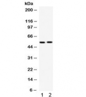 Western blot testing of 1) rat brain and 2) mouse brain lysate with GABRB3 antibody. Predicted/observed molecular weight ~54 kDa.