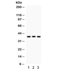 Western blot testing of 1) rat liver, 2) rat thymus and 3) human HeLa lysate with CTGF antibody. Predicted/observed molecular weight ~38 kDa.~