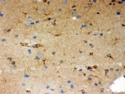 IHC testing of FFPE rat brain using SHC antibody. HIER: Boil the paraffin sections in pH 6, 10mM citrate buffer for 20 minutes and allow to cool prior to staining.
