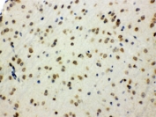 IHC testing of FFPE mouse brain using SHC antibody. HIER: Boil the paraffin sections in pH 6, 10mM citrate buffer for 20 minutes and allow to cool prior to staining.
