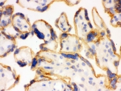 IHC testing of frozen human placenta using SHC antibody. HIER: Boil the paraffin sections in pH 6, 10mM citrate buffer for 20 minutes and allow to cool prior to staining.