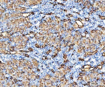 IHC staining of FFPE mouse kidney tissue with Aquaporin 1 antibody. HIER: boil tissue sections in pH8 EDTA for 20 min and allow to cool before testing.