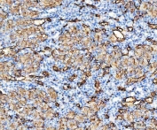 IHC staining of FFPE mouse kidney tissue with Aquaporin 1 antibody. HIER: boil tissue sections in pH8 EDTA for 20 min and allow to cool before testing.