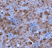 IHC staining of FFPE rat kidney tissue with Aquaporin 1 antibody. HIER: boil tissue sections in pH8 EDTA for 20 min and allow to cool before testing.