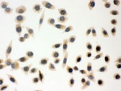 ICC testing of human SMCC cells with Peroxiredoxin 5 antibody.