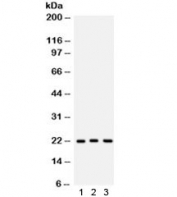 Western blot testing of 1) human A549, 2) rat brain and 3) mouse brain lysate with Peroxiredoxin 5 antibody. Expected molecular weight ~22 kDa.