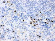 IHC testing of FFPE rat spleen with LCN2 antibody. HIER: Boil the paraffin sections in pH 6, 10mM citrate buffer for 20 minutes and allow to cool prior to staining.