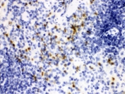 IHC testing of FFPE mouse spleen with LCN2 antibody. HIER: Boil the paraffin sections in pH 6, 10mM citrate buffer for 20 minutes and allow to cool prior to staining.