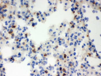 IHC testing of frozen mouse lung tissue with Lipocalin 2 antibody.