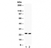 Western blot testing of 1) mouse lung and 2) mouse intestine lysate with LCN2 antibody. Predicted/observed molecular weight: 22-25 kDa.