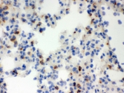 IHC testing of frozen mouse lung tissue with LCN2 antibody.
