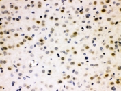 IHC testing of FFPE rat brain with CDC25B antibody. HIER: Boil the paraffin sections in pH 6, 10mM citrate buffer for 20 minutes and allow to cool prior to staining.