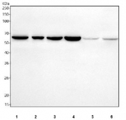 Western blot testing of 1) human Jurkat, 2) human Raji, 3) human HeLa, 4) human HepG2, 5) rat liver and 6) mouse liver tissue lysate with CDC25B antibody. Expected/observed molecular weight: 61~67 kDa (isoforms 1-4).