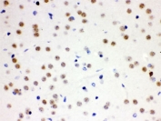 IHC testing of FFPE mouse brain with CDC25B antibody. HIER: Boil the paraffin sections in pH 6, 10mM citrate buffer for 20 minutes and allow to cool prior to staining.