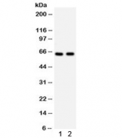 Western blot testing of 1) rat liver and 2) rat testis with CDC25B antibody. Expected/observed molecular weight: 61~67 kDa (isoforms 1-4).