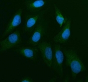 Western blot testing of 1) rat liver and 2) rat testis with CDC25B antibody. Expected/observed molecular weight: 61~67 kDa (isoforms 1-4).