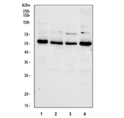 Western blot testing of human 1) 293T, 2) HeLa, 3) HepG2 and 4) K562 cell lysate with CDC25C antibody. Expected molecular weight: ~53/60 kDa (unmodified/phosphorylated).