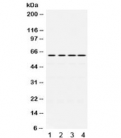 Western blot testing of 1) rat ovary, 2) rat liver, 3) human HeLa, 4) human SW620 lyate with CDC25C antibody. Expected molecular weight: ~53/60 kDa (unmodified/phosphorylated).