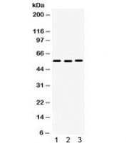 Western blot testing of human 1) HeLa, 2) SW620 and 3) MCF7 lysate with CDC25C antibody. Expected molecular weight: ~53/60 kDa (unmodified/phosphorylated).