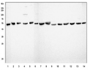 Western blot testing of 1) human HEK293, 2) human T-47D, 3) human PC-3, 4) human U-87 MG, 5) human HepG2, 6) monkey COS-7, 7) rat brain, 8) rat liver, 9) rat kidney, 10) rat RH35, 11) mouse brain, 12) mouse liver, 13) mouse kidney and 14) mouse HEPA1-6 lysate with AT1R antibody. Observed molecular weight ~41-50 kDa depending on glycosylation level.