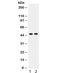 Western blot testing of 1) HeLa and 2) HEPA cell lysate with AT1R antibody. Observed molecular weight ~41-50 kDa depending on glycosylation level.