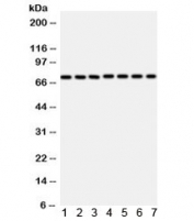 Western blot testing of 1) rat liver, 2) mouse liver, 3) rat brain, 4) mouse brain, 5) SMMC, 6) human placenta, and 7) SW620 lysate with SDHA antibody. Expected/observed molecular weight ~73 kDa.