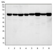 Western blot testing of 1) human 293T, 2) human MCF7, 3) human HepG2, 4) human HeLa, 5) rat brain, 6) rat kidney, 7) mouse brain and 8) mouse kidney tissue lysate with SDHA antibody. Predicted molecular weight ~73 kDa.
