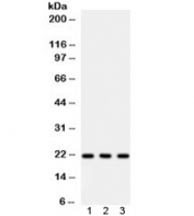 Western blot testing of 1) human MCF7, 2) human SW620 and 3) rat lung lysate with Syndecan 4 antibody. Expected/observed molecular weight: ~22 kDa.