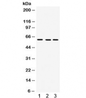 Western blot testing of 1) rat liver, 2) mouse liver and 3) human SMMC lysate with FMO3 antibody. Predicted/observed molecular weight ~60 kDa.