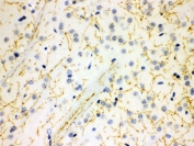 IHC testing of FFPE rat brain with SERT antibody. HIER: Boil the paraffin sections in pH 6, 10mM citrate buffer for 20 minutes and allow to cool prior to staining.