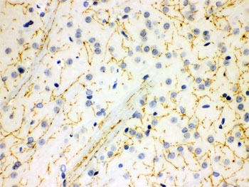 IHC testing of FFPE rat brain with SERT antibody. HIER: Boil the paraffin sections in pH 6, 10mM citrate buffer for 20 minutes and allow to cool prior to staining.