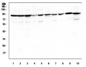 Western blot testing of 1) human HepG2, 2) human Caco-2, 3) human SW620, 4) human COLO-320, 5) human K562 6) human U-2 OS, 7) human U-87 MG, 8) rat heart, 9) mouse heart and 10) mouse SP2/0 cell lysate with SERT antibody. Expected molecular weight: ~70/85-95 kDa (unmodified/glycosylated).