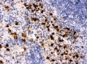 IHC testing of FFPE mouse spleen with S100A9 antibody. HIER: Boil the paraffin sections in pH 6, 10mM citrate buffer for 20 minutes and allow to cool prior to staining.