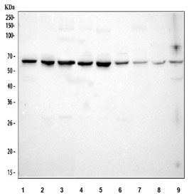 Western blot testing of 1) rat testis and 2) MCF7 lysate with STIP1 antibody. Expected molecular weight: 63/68/60 kDa (isoforms 1/2/3).