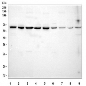 Western blot testing of 1) human HeLa, 2) human COLO-320, 3) human MCF7, 4) rat C6, 5) rat RH35, 6) mouse brain, 7) mouse liver, 8) mouse Neuro-2a and 9) mouse HEPA1-6 cell lysate with STIP1 antibody. Expected molecular weight: 63/68/60 kDa (isoforms 1/2/3).