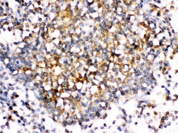 IHC testing of FFPE human tonsil with CD153 antibody. HIER: Boil the paraffin sections in pH 6, 10mM citrate buffer for 20 minutes and allow to cool prior to staining.~