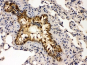 IHC testing of FFPE mouse lung with GRK5 antibody. HIER: Boil the paraffin sections in pH 6, 10mM citrate buffer for 20 minutes and allow to cool prior to staining.