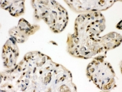 IHC testing of FFPE human placenta with GRK5 antibody. HIER: Boil the paraffin sections in pH 6, 10mM citrate buffer for 20 minutes and allow to cool prior to staining.