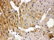 IHC testing of FFPE rat heart with GRK5 antibody. HIER: Boil the paraffin sections in pH 6, 10mM citrate buffer for 20 minutes and allow to cool prior to staining.