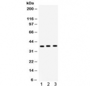 Western blot testing of 1) rat lung, 2) rat brain and 3) human PANC lysate with Surfactant protein D antibody. Predicted/observed molecular weight ~38 kDa.