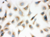 ICC testing of FFPE human HeLa cells with Surfactant protein D antibody. HIER: Boil the paraffin sections in pH 6, 10mM citrate buffer for 20 minutes and allow to cool prior to staining.