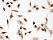 ICC testing of FFPE human A549 cells with Surfactant protein D antibody. HIER: Boil the paraffin sections in pH 6, 10mM citrate buffer for 20 minutes and allow to cool prior to staining.