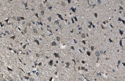 IHC staining of FFPE rat brain with ADRA1A antibody. HIER: boil tissue sections in pH6, 10mM citrate buffer, for 20 min and allow to cool before testing.