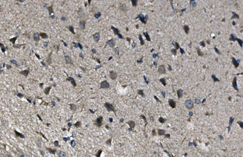 IHC staining of FFPE rat brain with ADRA1A antibody. HIER: boil tissue sections in pH6, 10mM citrate buffer, for 20 min and allow to cool before testing.