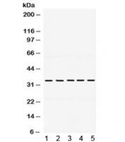 Western blot testing of 1) rat kidney, 2) mouse ovary, 3) human HeLa, 4) human MCF7 and 5) human SMMC lysate with TIMP3 antibody. Expected/observed molecular weight: ~24/33 kDa (unmodified/glycosylated).