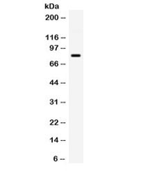 Western blot testing of human Jurkat cell lysate with GRK3 antibody. Expected/observed molecular weight ~80 kDa.