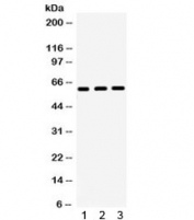 Western blot testing of 1) rat liver, 2) rat kidney, 3) human SW620 lysate with HNF1 beta antibody. Predicted/observed molecular weight ~61 kDa.